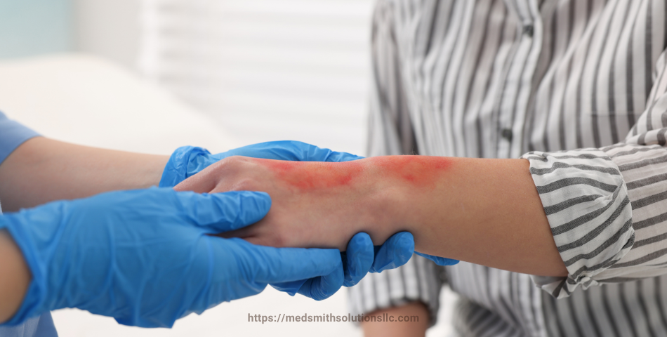 Understanding the Four Elements of Negligence in Burn Injury Lawsuits