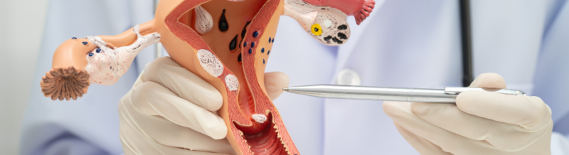 Understanding Gynecology Medical Negligence: The Role of Medical Records Review for Attorneys
