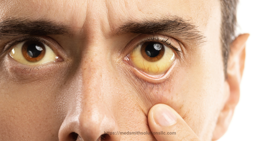 Understanding Eye Problems Caused by Elmiron: Risks, Symptoms, and Legal Implications