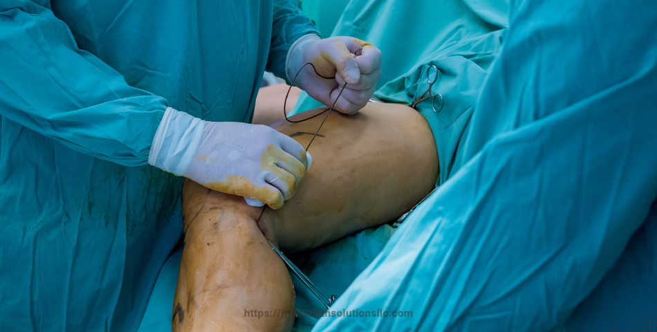 Understanding Anesthesia Injuries: A Comprehensive Guide for Attorneys