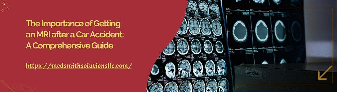 The Importance of Getting an MRI after a Car Accident A Comprehensive Guide