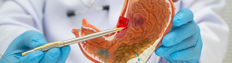 The Consequences Suffered from a Delayed Cancer Diagnosis: Synopsis for Attorneys