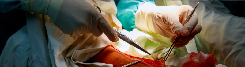 Top Surgical Errors That Lead to Medical Malpractice Lawsuits
