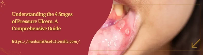 4 Stages of Pressure Ulcers